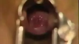 طبيبة النساء تفتح ساقي مريضتها وتلعب بفتحتيها